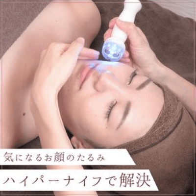 気になる顔のたるみ ハイパーナイフで解決